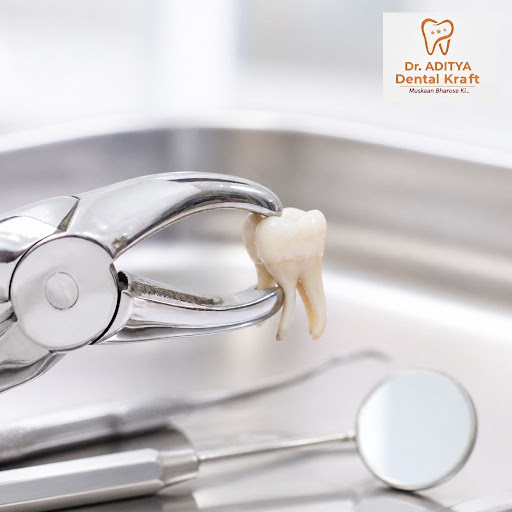 Worried that tooth removal will be painful and complicated? At Dr. Aditya Dental Kraft in Ghaziab… post image