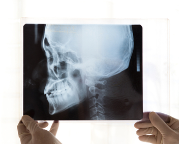 Oral & Maxillofacial Surgery Associates - Thumbnail