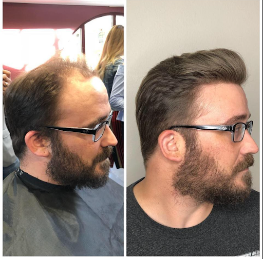 bombay hair clinique - Thumbnail