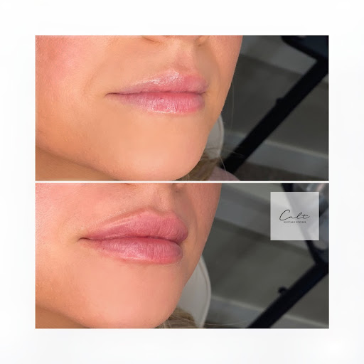 Cult Medical Aesthetics