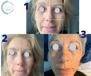 Photo n°16 de Corpo Minceur/Cryolipolyse/ Lille à Steenvoorde (Centre d'amincissement)