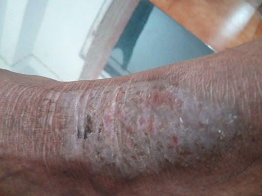 Cured within 1 month (Dr Soumya Dey's Clinic desk) 
