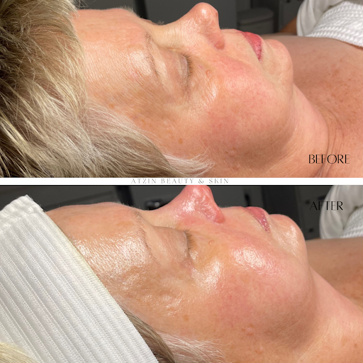 Atzin Beauty & Skin LLC - Thumbnail
