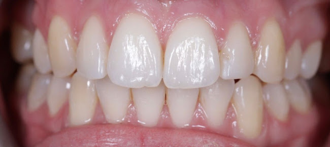 garforth dental - Invisalign Leeds - Dentist