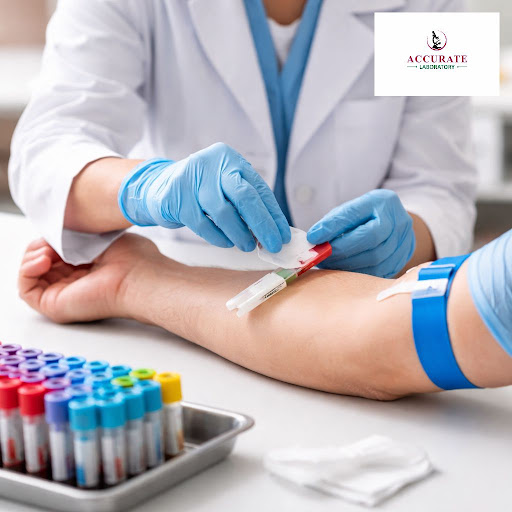 Getting a blood test should never feel stressful or unsafe. At Accurate Laboratory in Ghatlodiya,…