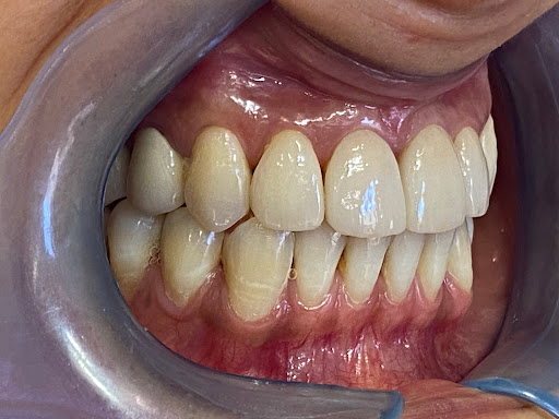 Clínica Dental Llibertat - Thumbnail