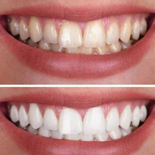 Zahnarzt Hanau | Zahnärztin Senah El-Abbasi - Zahnarztpraxis Smile & Shine