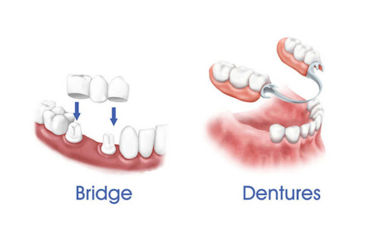 Radiating confidence begins with a healthy, complete smile, and at Vardan Dental Clinic every pat… post image