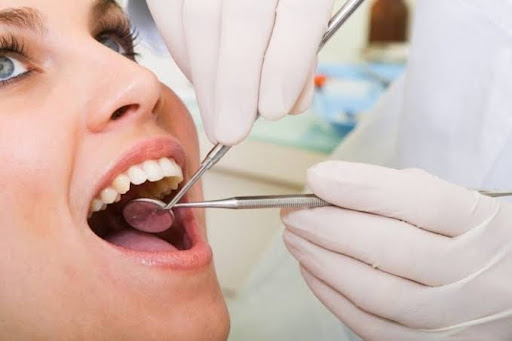 Free dental checkup and consultation post image