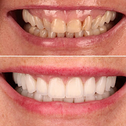 Photo n°22 de Dr Pierre Layan - Dentiste Esthetique à Paris à Paris (Dentiste cosmétique)