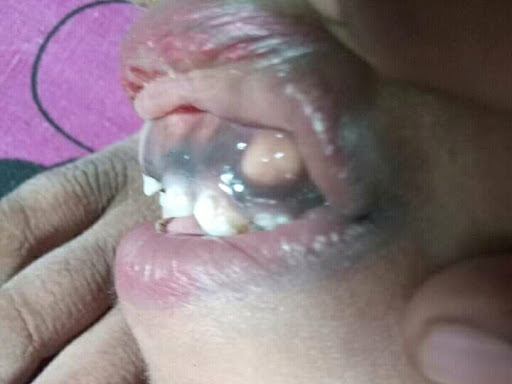 Cured within 2 weeks  (Dr Soumya Dey's Clinic desk)  post image