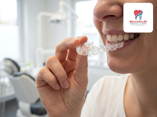 Dreaming of a perfectly aligned smile without metal braces? At Bhandari Dental Care in Sarkanda,… post image