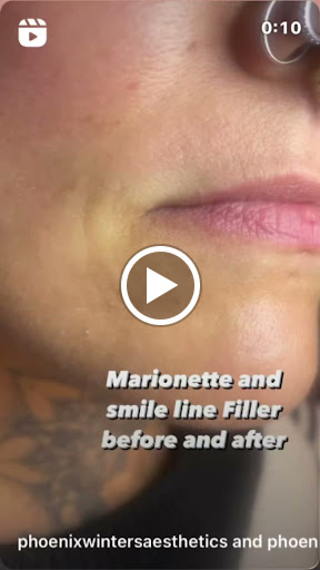 Phoenix Winters Aesthetics