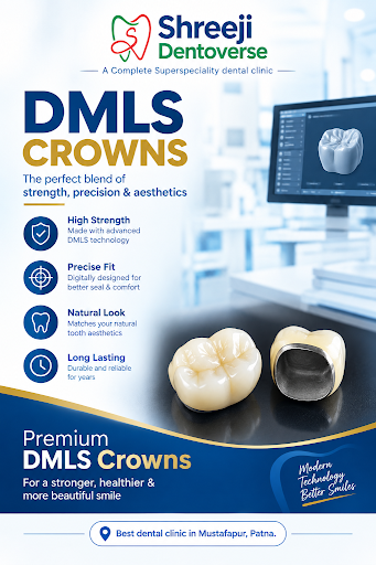 ✨ DMLS Crowns – Strength Meets Precision ✨