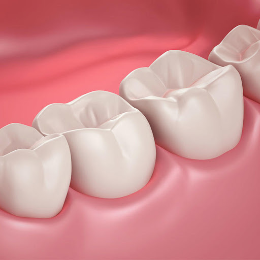 Beverly Smiles Family Dental - Thumbnail