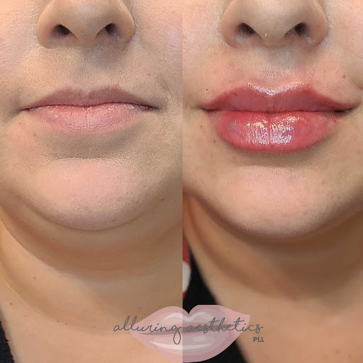 Alluring Aesthetics, PLLC