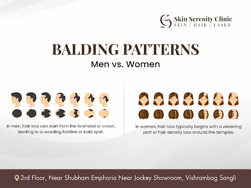 Did you know hair loss looks different in men and women? At Skin Serenity Clinic, Vishrambag Sang… post image