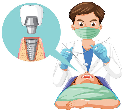 🦷 Smoke – Can I Still Get a Dental Implant? post image