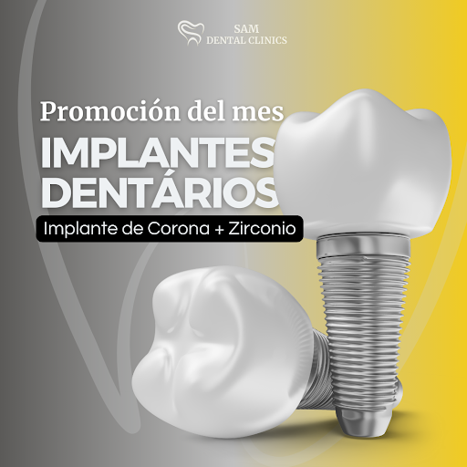 Sam Dental Clinics | Clinica Dental en Madrid/Carabanchel