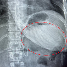 Photo n°20 de BIOLASER : Centre médical esthétique et laser à Saint-Louis/Basel à Saint-Louis (Service de détatouage)