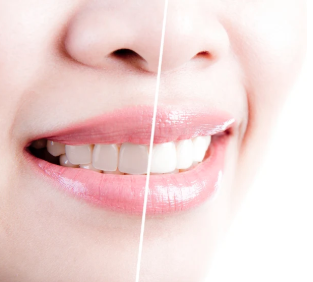 New Day Dentistry Littleton | Dr. Soondis Habil - Thumbnail