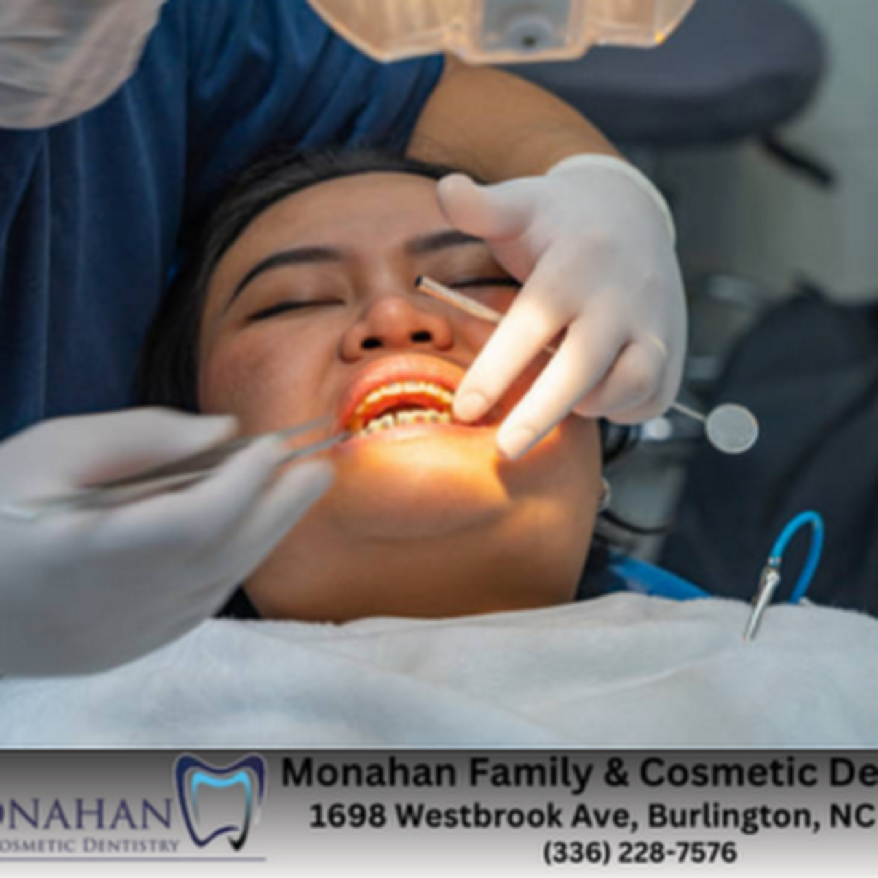 Tooth Bonding and Cosmetic Fixes - Dentists in Burlington, NC