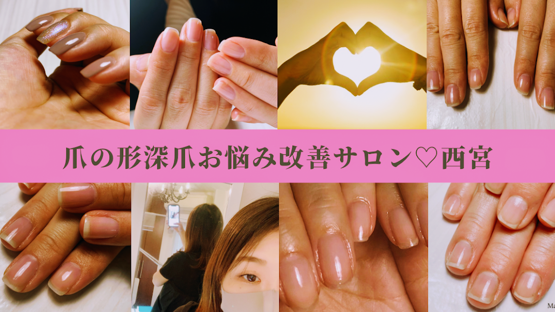 西宮ネイルサロン 爪のお悩み改善サロン ネイルサロン