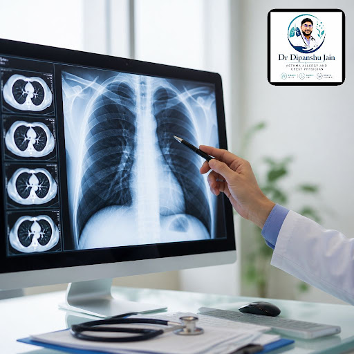 Breathing issues like asthma, allergies, chronic cough or TB can look similar on the surface, but… post image