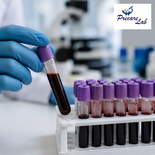 Understanding your blood reports is the first step to protecting your health. At Precare lab, Sec… post image