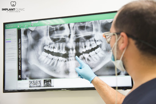 Dr. Marco Maciá Implant Clínic Benijofar - Thumbnail