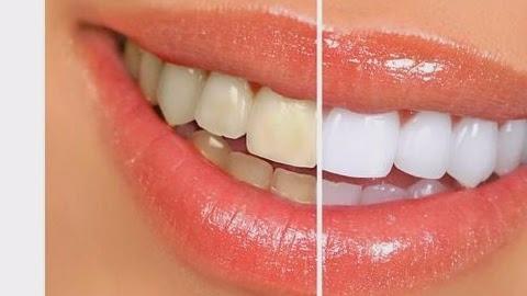 Dr. Gregory D. Perkins DDS Sandy