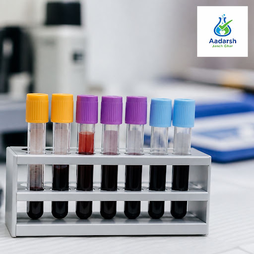 A complete metabolic panel is one of the most important blood tests to understand how your body i… post image