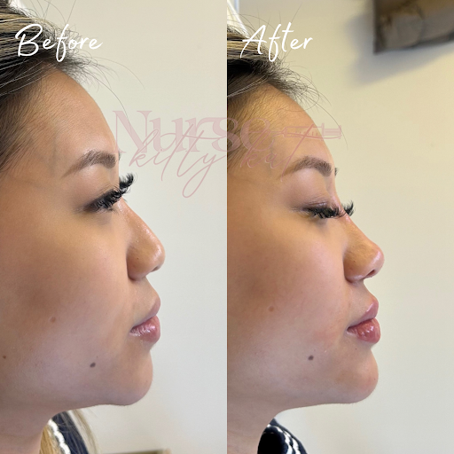 Nurse Kitty Kat Aesthetics