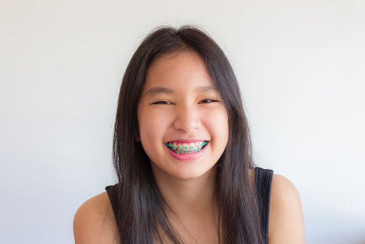 Mequon Smile Design - Thumbnail