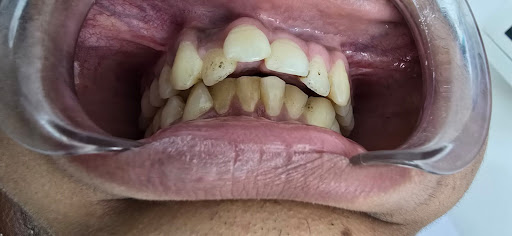 Ortho cases at 'Shreeji Dentoverse'.