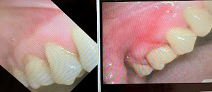 Photo n°20 de Dr André Escaut - Parodontiste à Paris (Parodontiste)