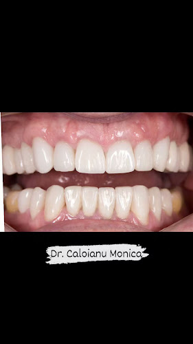 Opinii despre Dr. Caloianu Monica specialist ortodonție în Cluj - Dentist