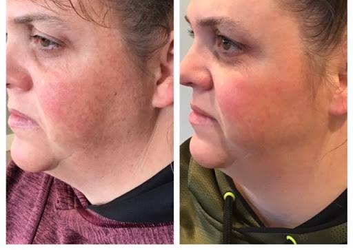 Minneapolis Anti-Aging & Skin Clinic