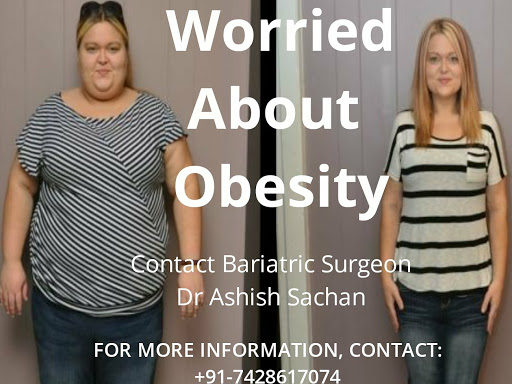 Contact Dr Ashish Sachan, Weight loss surgeon