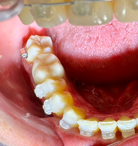 Consultorio Dental Abigail Morillón - Thumbnail