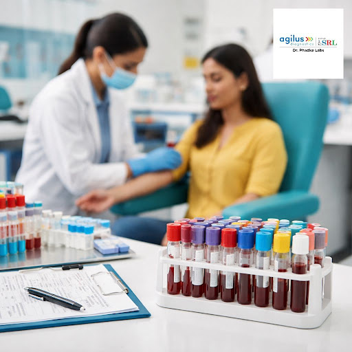 Stay ahead of health problems with comprehensive blood test packages at Agilus Diagnostics - Sect… post image