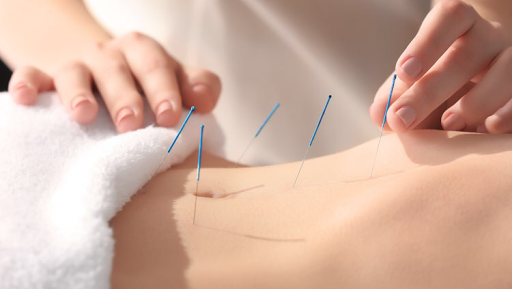 Granite State Acupuncture - Thumbnail