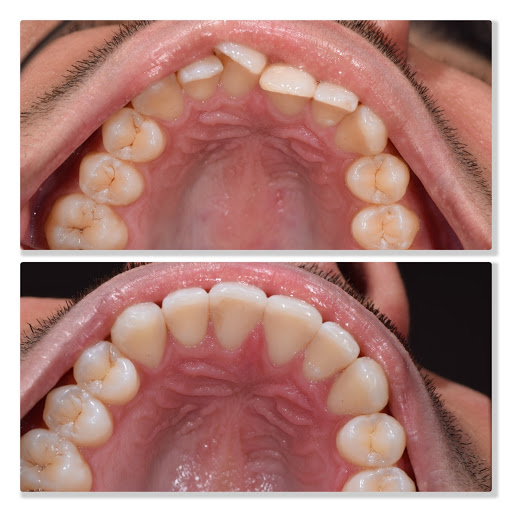 Infinity Dental Clinic - Thumbnail