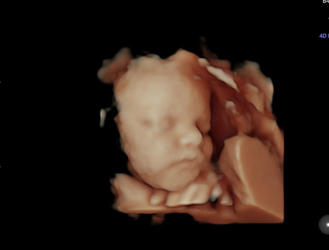 https://www.lollipop4dbabyscans.co.uk/manchester-city-centre/