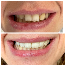 Photo n°8 de Dentiste - Dr Amar Jonathan Neuilly-Sur-Seine à Neuilly-sur-Seine (Urgences dentaires)