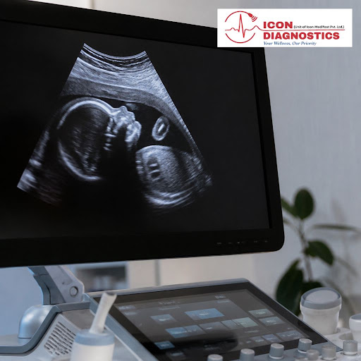 Anomaly scans play a vital role in monitoring your baby’s growth and detecting any concerns at th… post image