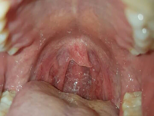 Cured within 1 month  (Dr Soumya Dey's Clinic desk) 