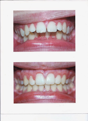 Chino Family Dental - Thumbnail
