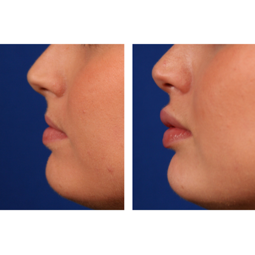 Bailey Cosmetic Surgery & Vein Centre