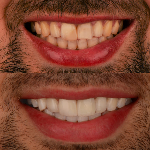 CLINICA DENTAL ODONTOFAM - Dentista Villaviciosa de Odón - Thumbnail